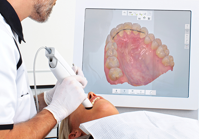Avaliação odontológica com escaneamento digital 3D do sorriso